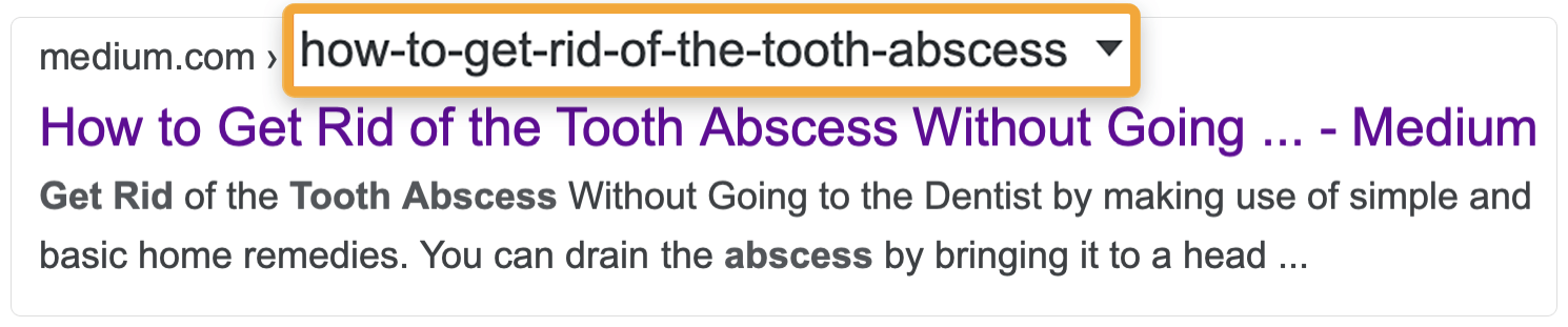 Removing unnecessary stop words, via google.com 